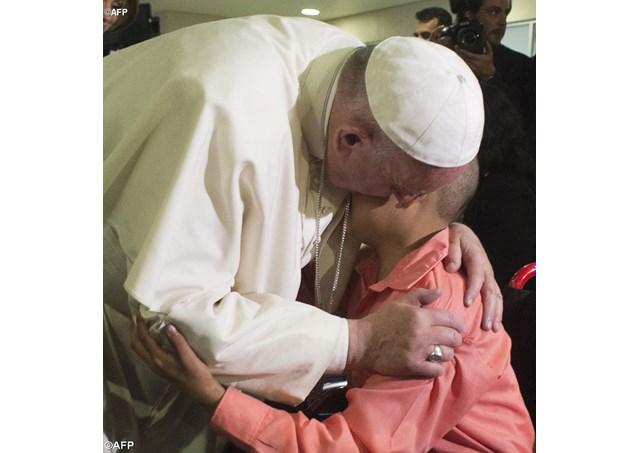 papa Francesco abbraccio bimbo malato